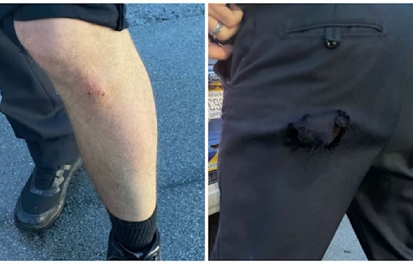 Get a Load of the Cop’s ‘Injuries’ Caused by Scottie Scheffler