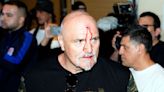 Tyson Fury's dad John left bloodied after headbutting Oleksandr Usyk team member in violent bust-up