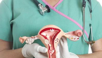 Cáncer de ovario: los cinco síntomas que se confunden con una molestia intestinal