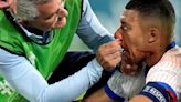 Videos y fotos: así fue la fractura de Mbappé