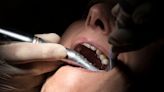 Indigenous people in remote communities may not see much benefit from national dental care plan