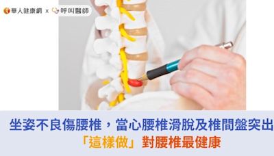 坐姿不良傷腰椎，當心腰椎滑脫及椎間盤突出！「這樣做」對腰椎最健康