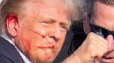 Trump injured but ‘fine’ after attempted assassination at rally