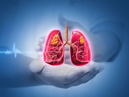 Roche’s Phase II/III NSCLC treatment trial fails to meet primary endpoints