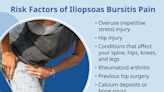 What Is Iliopsoas Bursitis?