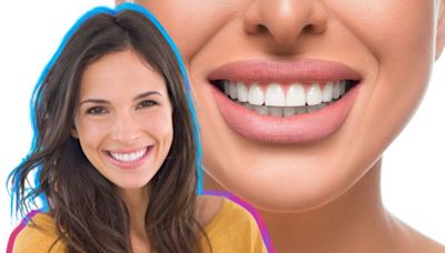 Cómo es el truco profesional para tener dientes blancos y sonrisa perfecta sin mascarillas ni químicos