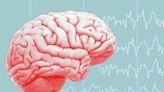 Indian-origin neurologist develops method to predict seizures in epilepsy patients