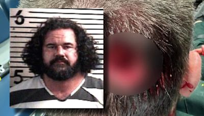 Florida man allegedly bites chunk out of deputy's head at music festival