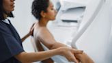 Women should start getting mammograms at 40, new guidance says