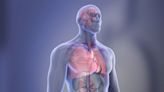 Persistent asthma linked to increased buildup of plaque in arteries leading to the brain