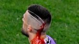 Fiorentina captain Cristiano Biraghi speaks out after being left bloodied by West Ham fan missiles