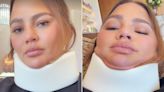 Chrissy Teigen Models a Neck Brace and Jokes She Skipped the 2024 Met Gala Because a Headstand 'Didn’t Go Well'