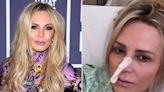 Tamra Judge Hospitalized for Intestinal Obstruction: ‘Praying I Won’t Need Surgery’