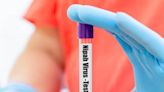 ...Kerala Nipah Virus Outbreak: Deceased Boy's Close Relatives Test Negative; 142 Healthcare Workers In Contact List Tagged '...