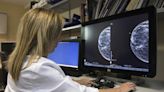 La edad y el grupo racial afectan la inteligencia artificial en los mamogramas digitales