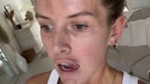 Love Island's Faye Winter details skin battle in makeup-free video