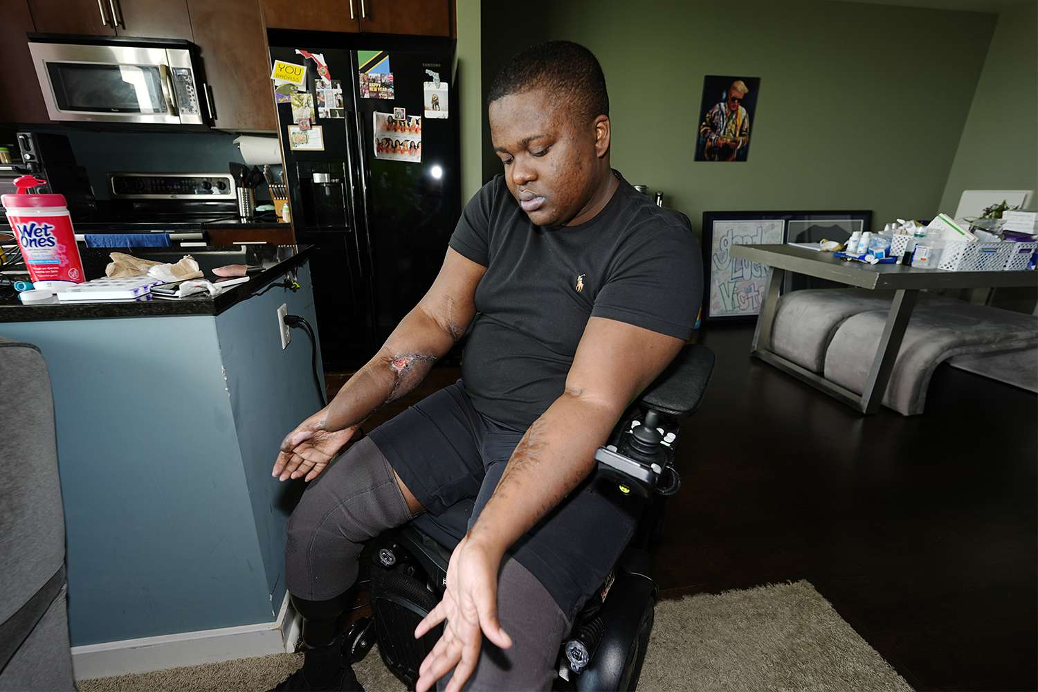 Ex-Police Recruit Files Suit After Losing Legs in Alleged ‘Barbaric' Hazing Ritual: 'No Idea What My Future Holds'
