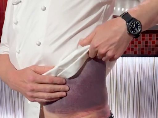 ‘I’m lucky to be here’: Gordon Ramsay suffers horrific bruises in cycling accident