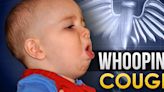 Medina County children test positive for whooping cough