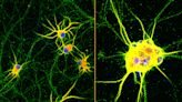 Lab grown nerve cells ‘holds promise for neurodegenerative disease’