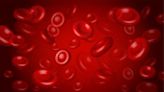 Efanesoctocog alfa prophylaxis beneficial for children with hemophilia A