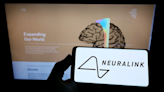 Neuralink dice que su primer implante cerebral en un ser humano encontró un problema de pérdida de datos - Diario El Sureño