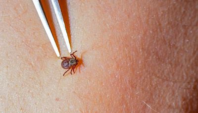 Lyme disease is becoming more common. But its symptoms aren't always easy to spot