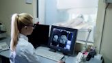 Científicos chilenos descubren la dieta que frenaría el envejecimiento del cerebro