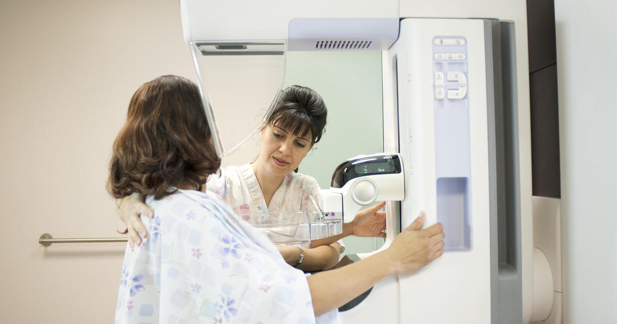 Mammogram patients now have to be told about their breast density. Here's what to know.