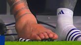 Sobrecogedor: así ha quedado el tobillo de Leo Messi