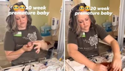 Video Of Mother Wrapping 5-month-old Premature Baby In A Towel Viral - News18