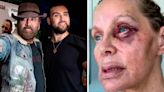 Ex de Nicolas Cage revela ferimentos causados por agressões sofridas pelo filho com o ator