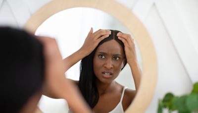 5 reasons women experience hair loss