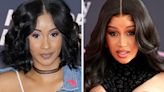 Cardi B Got Candid About Her Latest Plastic Surgery And Removing 95% Of Her Butt Injections