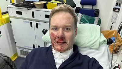 Dan Walker reveals he doesn't remember his near-fatal bike accident