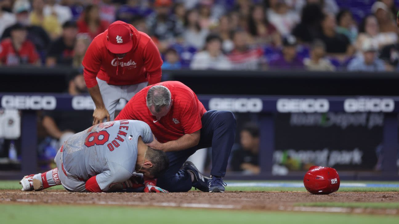 Cardinals' Arenado exits after being hit by pitch