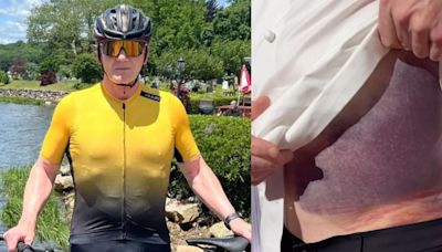 Gordon Ramsay Opens Up About His Horrific Bike Accident: 'I Thought I Was Going To Pass Out'