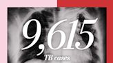 After steady decline, TB has increased every year since 2020 in U.S.