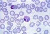 Plasmodium vivax