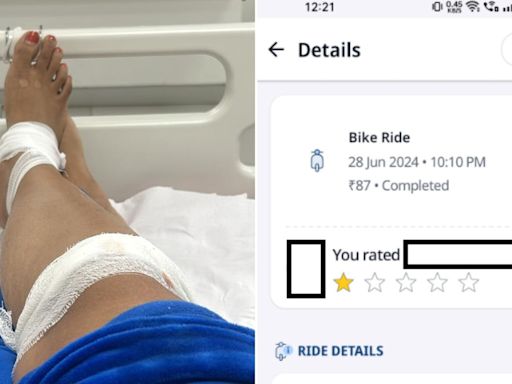 23-year-old Google techie alleges Bengaluru Rapido driver's rash driving left her with injured leg: ‘I can’t imagine…'