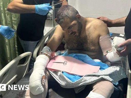 Gaza war: Palestinian anti-Hamas activist beaten by masked men