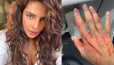 'The Bluff': Priyanka Chopra shows off her injured hand in new video but it's not what you think