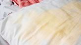 Whiten yellow pillows and clean stains with one ‘magic’ natural ingredient