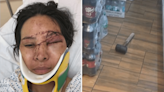 Mother clings to life after beaten with sledgehammer in latest in spate of NYC bodega attacks