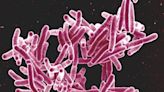 Breakthrough aerosol human infection model gives hope for future TB vaccine development