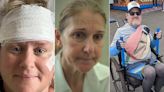 'Fiquei incapaz de funcionar': pacientes com o mesmo diagnóstico de Céline Dion falam sobre conviver com a síndrome