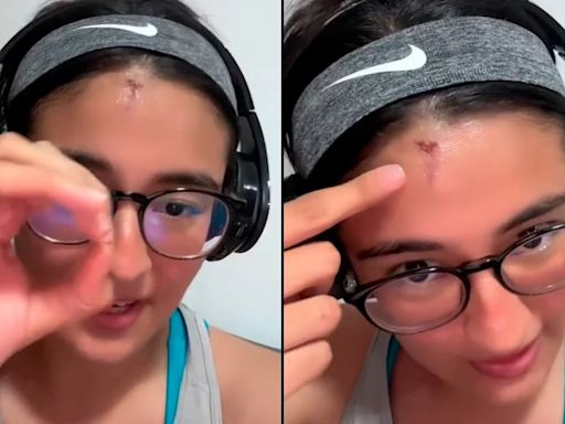 Intensa lluvia en Monterrey “descalabra” a una joven con un granizo y se vuelve viral