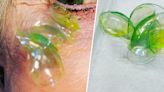 Woman Had 23 Contact Lenses Stuck Under Her Eyelid, Doctor Says