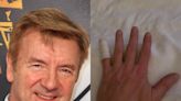 ‘Broken’: Dancing on Ice star Christopher Dean suffers sudden injury days before series begins