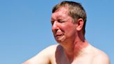 My unorthodox trick will drastically reduce discomfort when you get a sunburn